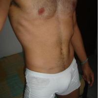 penesote20cm