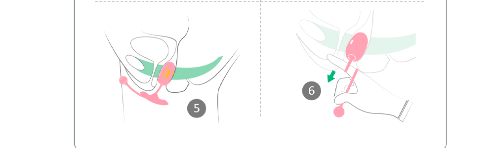 Vibrador Magic Kegel Coach Controlado por APP Global